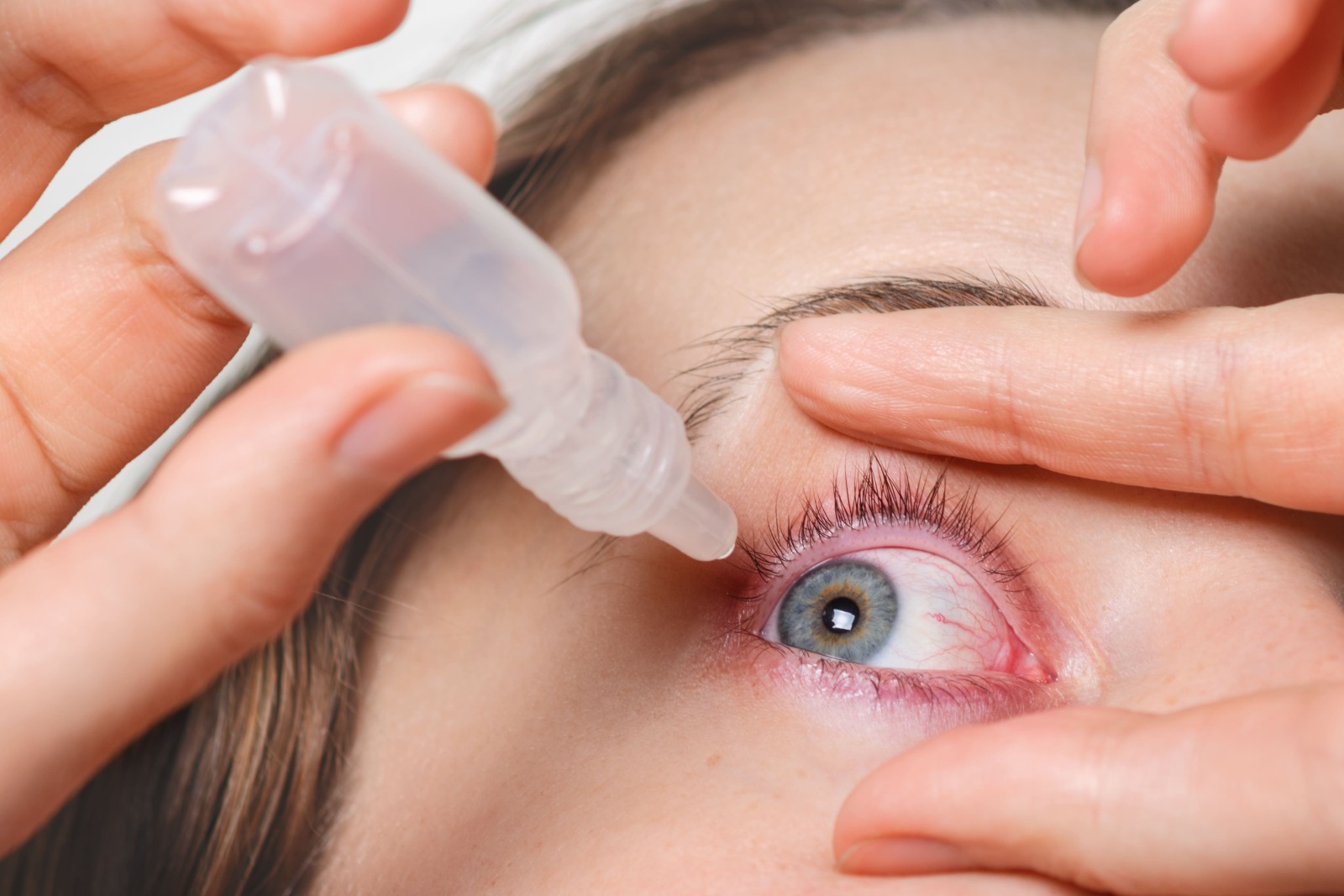 Pessoa aplicando colírio em olhos avermelhados